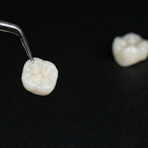Tweezers holding up a ceramic dental crown