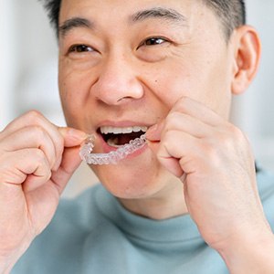 Man smiling while putting on clear aligner