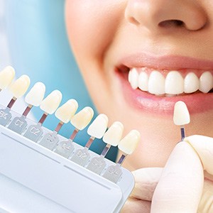 Having teeth shade-matched for cosmetic dentistry