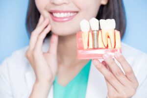 Dentist touching cheek while holding sample implant