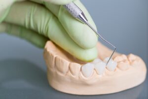 Gloved hand using dental tool on crowns.
